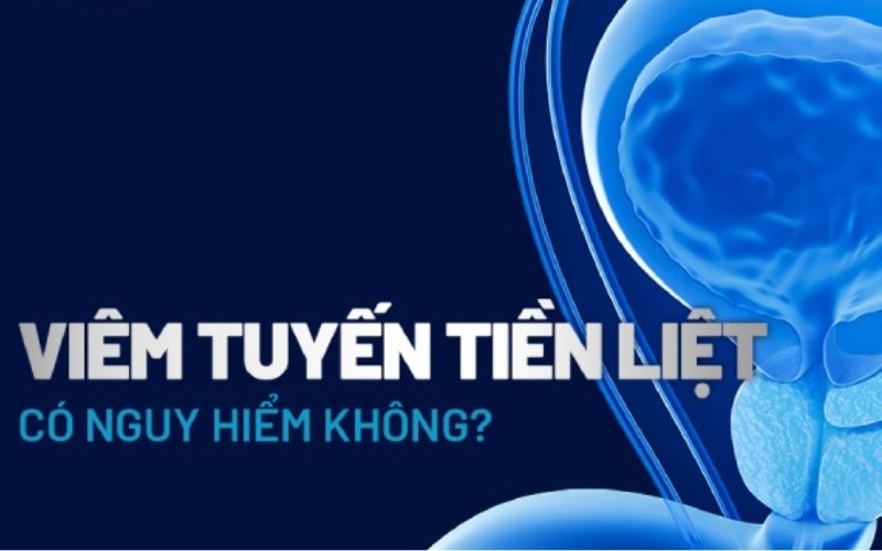 Bệnh viêm tiền liệt tuyến có nguy hiểm không