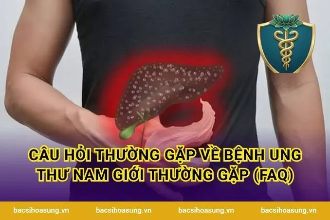 Câu hỏi thường gặp về bệnh ung thư nam giới thường gặp (FAQ)
