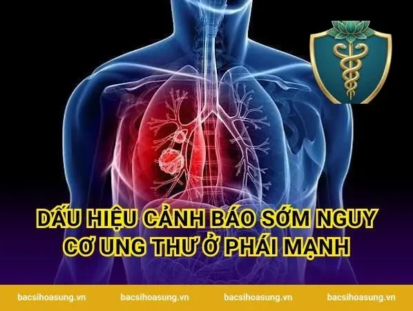 Dấu hiệu cảnh báo sớm nguy cơ ung thư ở phái mạnh